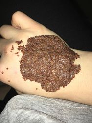 #3:  живой коллаген